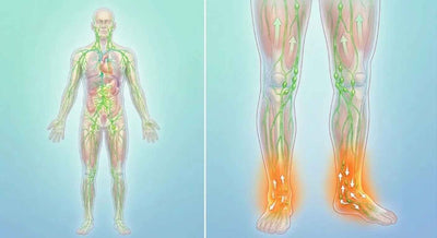 Illustration of lymphatic congestion and fluid buildup
